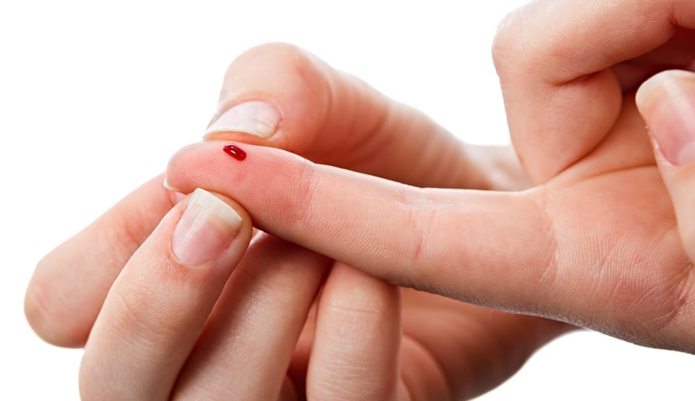 Omega-3 index blood test