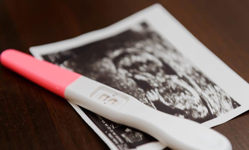 a pregnancy test and ultrasound photo